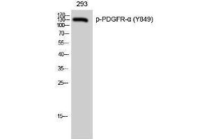 Western Blotting (WB) image for anti-Platelet Derived Growth Factor Receptor alpha (PDGFRA) (pTyr849) antibody (ABIN3182336) (PDGFRA anticorps  (pTyr849))