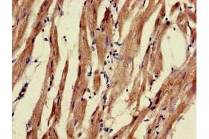 Immunohistochemistry of paraffin-embedded human heart tissue using ABIN7162571 at dilution of 1:100