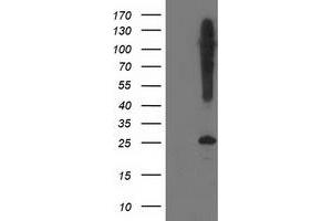 Western Blotting (WB) image for anti-Synaptosomal-Associated Protein, 25kDa (SNAP25) antibody (ABIN1501015) (SNAP25 anticorps)