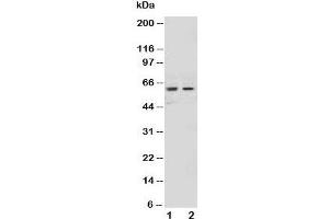 Western blot testing of NOX1 antibody and Lane 1:  HeLa;  2: MCF-7 cell lysate