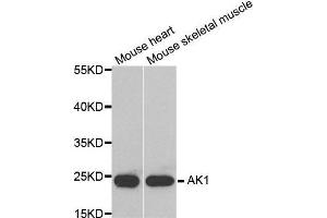 Western blot analysis of extracts of various tissues, using AK1 antibody. (Adenylate Kinase 1 anticorps  (AA 1-194))