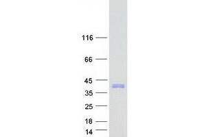 Validation with Western Blot