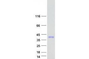Validation with Western Blot (SRA1 Protein (Myc-DYKDDDDK Tag))
