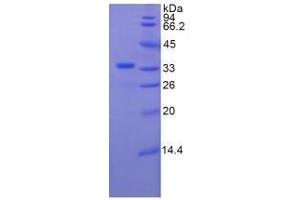 SDS-PAGE analysis of Human Plexin B1 Protein. (PLXNB1 Protéine)