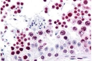 Human Testis: Formalin-Fixed, Paraffin-Embedded (FFPE)