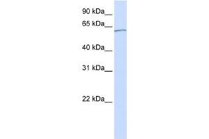 WB Suggested Anti-KPNA5 Antibody Titration: 0. (KPNA5 anticorps  (C-Term))