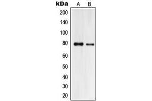 Western blot analysis of Praja2 expression in HeLa (A), HL60 (B) whole cell lysates. (PJA2 anticorps  (Center))