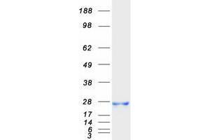 Validation with Western Blot