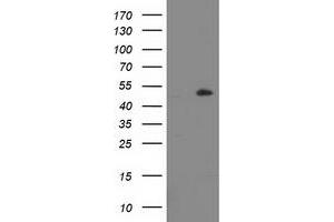 Western Blotting (WB) image for anti-Lipoprotein Lipase (LPL) (AA 28-475) antibody (ABIN1491317) (Lipoprotein Lipase anticorps  (AA 28-475))