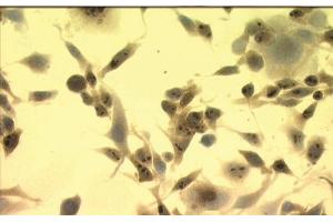 Image no. 3 for anti-Heat Shock Protein 70 (HSP70) (AA 436-503) antibody (ABIN466875) (HSP70 anticorps  (AA 436-503))