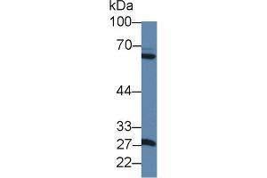 Western blot analysis of Rat Pancreas lysate, using Rat MMP1 Antibody (1 µg/ml) and HRP-conjugated Goat Anti-Rabbit antibody ( (MMP1 anticorps  (AA 169-464))