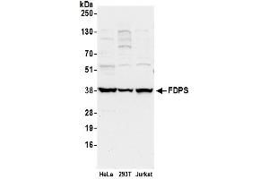 Western Blotting (WB) image for anti-Farnesyl Diphosphate Synthase (FDPS) (AA 50-100) antibody (ABIN7449734)