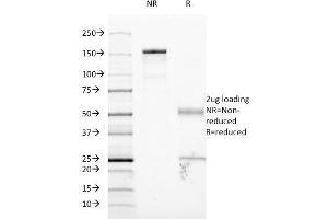 SDS-PAGE Analysis Purified CD54 Monoclonal Antibody (W-CAM-1).