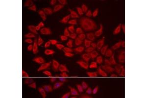 Immunofluorescence analysis of HeLa cells using AGPAT2 Polyclonal Antibody (AGPAT2 anticorps)