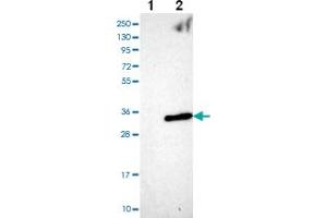Western blot analysis of Lane 1: Negative control (vector only transfected HEK293T lysate) Lane 2: Over-expression Lysate (Co-expressed with a C-terminal myc-DDK tag (~3. (ANKRD46 anticorps)