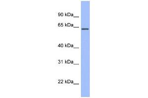 WB Suggested Anti-RPA1 Antibody Titration: 0. (RPA1 anticorps  (Middle Region))
