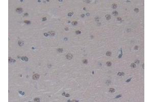 Detection of F13A1 in Rat Cerebrum Tissue using Polyclonal Antibody to Coagulation Factor XIII A1 Polypeptide (F13A1)