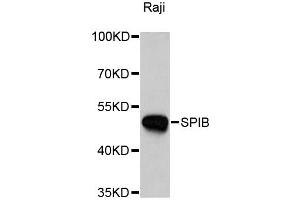 Western blot analysis of extracts of Raji cells, using SPIB antibody. (SPIB anticorps)