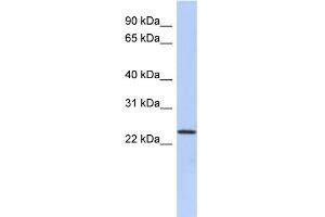 WB Suggested Anti-ULBP1 Antibody Titration:  0. (ULBP1 anticorps  (N-Term))