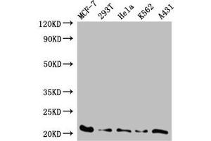 Western Blot Positive WB detected in: MCF-7 whole cell lysate, 293T whole cell lysate, Hela whole cell lysate, K562 whole cell lysate, A431 whole cell lysate All lanes: AK6 antibody at 0.