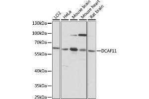 Western blot analysis of extracts of various cell lines, using DC antibody (ABIN7266680) at 1:1000 dilution. (DCAF11 anticorps  (AA 1-170))