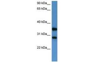 Image no. 1 for anti-serine/threonine/tyrosine Interacting-Like 1 (STYXL1) (AA 140-189) antibody (ABIN6746820) (STYXL1 anticorps  (AA 140-189))