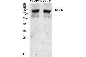 Western Blot (WB) analysis of specific cells using MDM2 Polyclonal Antibody. (MDM2 anticorps  (Ser880))