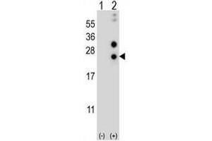 Western blot analysis of CSN1S1 (arrow) using rabbit polyclonal CSN1S1 Antibody (Center) .