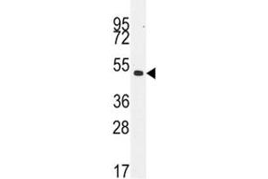 Western blot analysis of Desmin antibody and NCI-H460 lysate