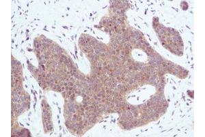 Image no. 2 for anti-Chemokine (C-X-C Motif) Ligand 10 (CXCL10) antibody (ABIN465012) (CXCL10 anticorps)