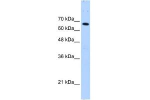 WB Suggested Anti-FBXW7 Antibody Titration:  0. (FBXW7 anticorps  (C-Term))
