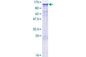 Image no. 1 for Tax1 (Human T-Cell Leukemia Virus Type I) Binding Protein 1 (TAX1BP1) (AA 1-789) protein (GST tag) (ABIN1322194)