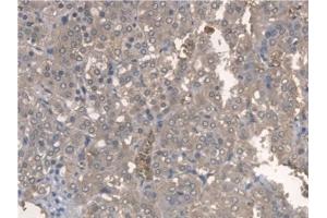 Detection of ARNTL in Rat Adrenal gland Tissue using Polyclonal Antibody to Aryl Hydrocarbon Receptor Nuclear Translocator Like Protein (ARNTL)