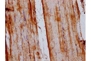 IHC image of ABIN7170110 diluted at 1:200 and staining in paraffin-embedded human skeletal muscle tissue performed on a Leica BondTM system.