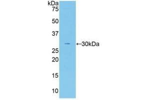 Detection of Recombinant F5, Human using Polyclonal Antibody to Coagulation Factor V (F5)