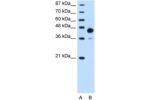 Western Blotting (WB) image for anti-Homeobox C10 (HOXC10) antibody (ABIN2461879) (HOXC10 anticorps)