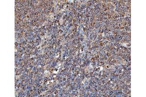 IHC analysis of EEF2 using anti-EEF2 antibody (ABIN7599561). (EEF2 anticorps  (AA 1-858))