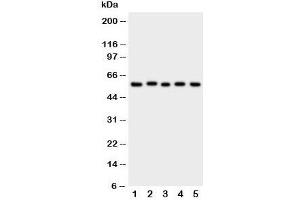 Western blot testing of ASIC3 antibody and Lane 1:  rat brain;  2: (r) testis;  3: human U87;  4: mouse Neuro-2a;  5: (h) SMMC-7721 cell lysate. (ASIC3 anticorps  (N-Term))