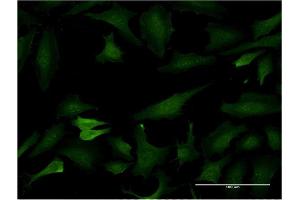 Immunofluorescence of monoclonal antibody to BCL7C on HeLa cell.