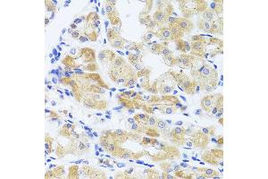 Immunohistochemistry of paraffin-embedded human stomach using INADL antibody at dilution of 1:100 (x40 lens). (PATJ anticorps)