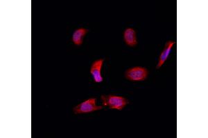 ABIN6257639 and ABIN6274782 staining Hela by IF/ICC. (RPL39 anticorps  (C-Term))