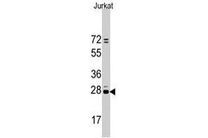 Western blot analysis of CD9 polyclonal antibody  in Jurkat cell line lysates (35 ug/lane).