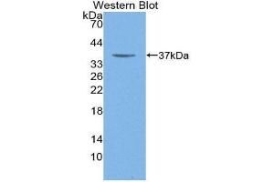 Western Blotting (WB) image for anti-Myosin Heavy Chain 6, Cardiac Muscle, alpha (MYH6) (AA 856-1116) antibody (ABIN1111122) (MYH6 anticorps  (AA 856-1116))