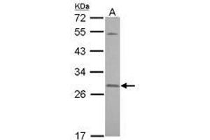 Image no. 2 for anti-Synaptosomal-Associated Protein, 23kDa (SNAP23) (AA 6-211) antibody (ABIN1501021) (SNAP23 anticorps  (AA 6-211))