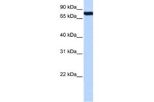 WB Suggested Anti-ZNF33A Antibody Titration:  0. (ZNF33A anticorps  (Middle Region))