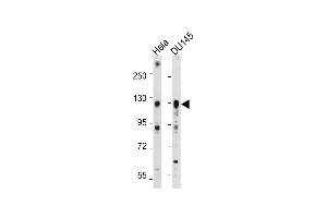 All lanes : Anti-AXL Antibody at 1:2000 dilution Lane 1: Hela whole cell lysate Lane 2: D whole cell lysate Lysates/proteins at 20 μg per lane. (AXL anticorps)