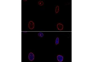 Confocal immunofluorescence analysis of U-2OS cells using Emerin/Emerin/EMD antibody  at dilution of 1:100. (Emerin anticorps  (AA 1-220))