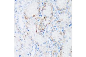 Immunohistochemistry of paraffin-embedded Rat kidney using GTPBP8 Rabbit pAb (ABIN7267527) at dilution of 1:100 (40x lens). (GTPBP8 anticorps  (AA 1-170))