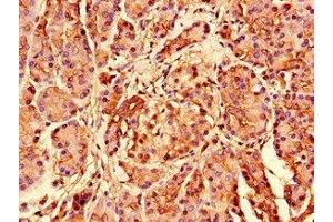 Immunohistochemistry of paraffin-embedded human pancreatic tissue using ABIN7142536 at dilution of 1:100