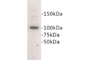 Western Blotting (WB) image for anti-Cadherin 1, Type 1, E-Cadherin (Epithelial) (CDH1) (Extracellular) antibody (ABIN1854887)